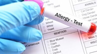 Food Allergy Test