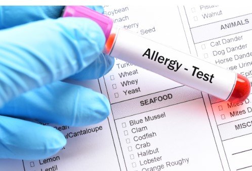 Food Allergy Test